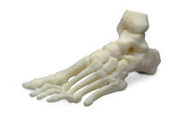 3D printing of human bones