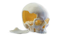 3D printing of head bones